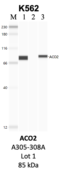 Bethyl_A305-308A_1_ACO2.png<br>Caption: IP-WB analysis of K562 whole cell lysate using the ACO2 specific antibody, A305-308A. Lanes 1 and 2 are 2.5% of five million whole cell lysate input and 50% of IP enrichment, respectively, using a normal IgG antibody. Lane 3 is 50% of IP enrichment from five million whole cell lysate using the ACO2-specific antibody, A305-308A. The same antibody was used to detect protein levels via Western blot. This antibody passes preliminary validation and will be further pursued for secondary validation. *NOTE* Protein sizes are taken from Genecards.org and are only estimates based on sequence. Actual protein size may differ based on protein characteristics and electrophoresis method used.