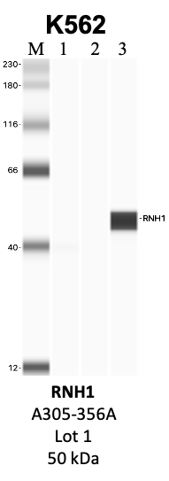 Bethyl_A305-356A_1_RNH1.png<br>Caption: IP-WB analysis of K562 whole cell lysate using the RNH1 specific antibody, A305-356A. Lanes 1 and 2 are 2.5% of five million whole cell lysate input and 50% of IP enrichment, respectively, using a normal IgG antibody. Lane 3 is 50% of IP enrichment from five million whole cell lysate using the RNH1-specific antibody, A305-356A. The same antibody was used to detect protein levels via Western blot. This antibody passes preliminary validation and will be further pursued for secondary validation. *NOTE* Protein sizes are taken from Genecards.org and are only estimates based on sequence. Actual protein size may differ based on protein characteristics and electrophoresis method used.