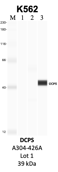 Bethyl_A305-426A_1_DCPS.png<br>Caption: IP-WB analysis of K562 whole cell lysate using the DCPS specific antibody, A305-426A. Lanes 1 and 2 are 2.5% of five million whole cell lysate input and 50% of IP enrichment, respectively, using a normal IgG antibody. Lane 3 is 50% of IP enrichment from five million whole cell lysate using the DCPS-specific antibody, A305-426A. The same antibody was used to detect protein levels via Western blot. This antibody passes preliminary validation and will be further pursued for secondary validation. *NOTE* Protein sizes are taken from Genecards.org and are only estimates based on sequence. Actual protein size may differ based on protein characteristics and electrophoresis method used.