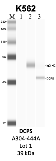 Bethyl_A305-444A_1_DCPS.png<br>Caption: IP-WB analysis of K562 whole cell lysate using the DCPS specific antibody, A305-444A. Lanes 1 and 2 are 2.5% of five million whole cell lysate input and 50% of IP enrichment, respectively, using a normal IgG antibody. Lane 3 is 50% of IP enrichment from five million whole cell lysate using the DCPS-specific antibody, A305-444A. The same antibody was used to detect protein levels via Western blot. This antibody passes preliminary validation and will be further pursued for secondary validation. *NOTE* Protein sizes are taken from Genecards.org and are only estimates based on sequence. Actual protein size may differ based on protein characteristics and electrophoresis method used.