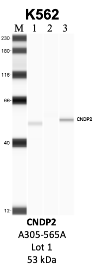 Bethyl_A305-565A_1_CNDP2.png<br>Caption: IP-WB analysis of K562 whole cell lysate using the CNDP2 specific antibody, A305-565A. Lanes 1 and 2 are 2.5% of five million whole cell lysate input and 50% of IP enrichment, respectively, using a normal IgG antibody. Lane 3 is 50% of IP enrichment from five million whole cell lysate using the CNDP2-specific antibody, A305-565A. The same antibody was used to detect protein levels via Western blot. This antibody passes preliminary validation and will be further pursued for secondary validation. *NOTE* Protein sizes are taken from Genecards.org and are only estimates based on sequence. Actual protein size may differ based on protein characteristics and electrophoresis method used.