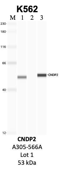 Bethyl_A305-566A_1_CNDP2.png<br>Caption: IP-WB analysis of K562 whole cell lysate using the CNDP2 specific antibody, A305-566A. Lanes 1 and 2 are 2.5% of five million whole cell lysate input and 50% of IP enrichment, respectively, using a normal IgG antibody. Lane 3 is 50% of IP enrichment from five million whole cell lysate using the CNDP2-specific antibody, A305-566A. The same antibody was used to detect protein levels via Western blot. This antibody passes preliminary validation and will be further pursued for secondary validation. *NOTE* Protein sizes are taken from Genecards.org and are only estimates based on sequence. Actual protein size may differ based on protein characteristics and electrophoresis method used.