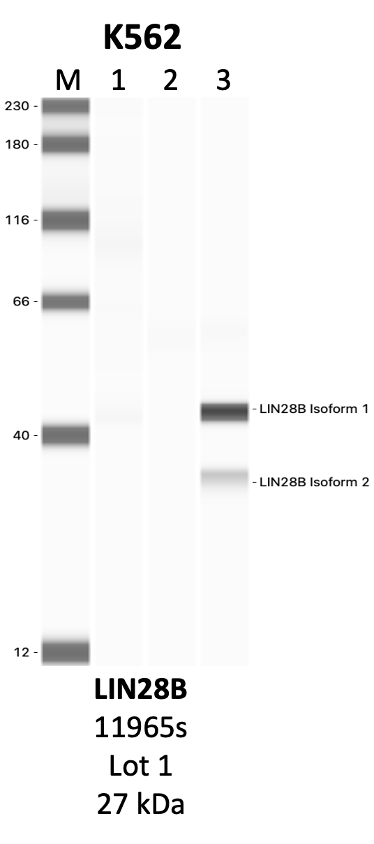 CST_11965S_1_LIN28B.png<br>Caption: IP-WB analysis of 11965S whole cell lysate using the LIN28B specific antibody, 11965S. Lanes 1 and 2 are 2.5% of five million whole cell lysate input and 50% of IP enrichment, respectively, using a normal IgG antibody. Lane 3 is 50% of IP enrichment from five million whole cell lysate using the LIN28B-specific antibody, 11965S. The same antibody was used to detect protein levels via Western blot. This antibody passes preliminary validation and will be further pursued for secondary validation. *NOTE* Protein sizes are taken from Genecards.org and are only estimates based on sequence. Actual protein size may differ based on protein characteristics and electrophoresis method used.