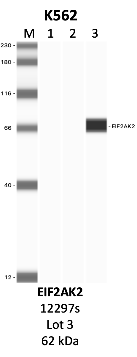 CST_12297S_3_EiF2AK2.png<br>Caption: IP-WB analysis of 12297S whole cell lysate using the EiF2AK2 specific antibody, 12297S. Lanes 1 and 2 are 2.5% of five million whole cell lysate input and 50% of IP enrichment, respectively, using a normal IgG antibody. Lane 3 is 50% of IP enrichment from five million whole cell lysate using the EiF2AK2-specific antibody, 12297S. The same antibody was used to detect protein levels via Western blot. This antibody passes preliminary validation and will be further pursued for secondary validation. *NOTE* Protein sizes are taken from Genecards.org and are only estimates based on sequence. Actual protein size may differ based on protein characteristics and electrophoresis method used.