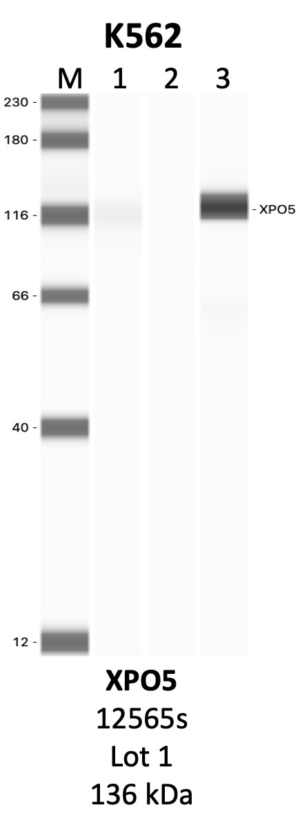 CST_12565S_1_XPO5.png<br>Caption: IP-WB analysis of 12565S whole cell lysate using the XPO5 specific antibody, 12565S. Lanes 1 and 2 are 2.5% of five million whole cell lysate input and 50% of IP enrichment, respectively, using a normal IgG antibody. Lane 3 is 50% of IP enrichment from five million whole cell lysate using the XPO5-specific antibody, 12565S. The same antibody was used to detect protein levels via Western blot. This antibody passes preliminary validation and will be further pursued for secondary validation. *NOTE* Protein sizes are taken from Genecards.org and are only estimates based on sequence. Actual protein size may differ based on protein characteristics and electrophoresis method used.