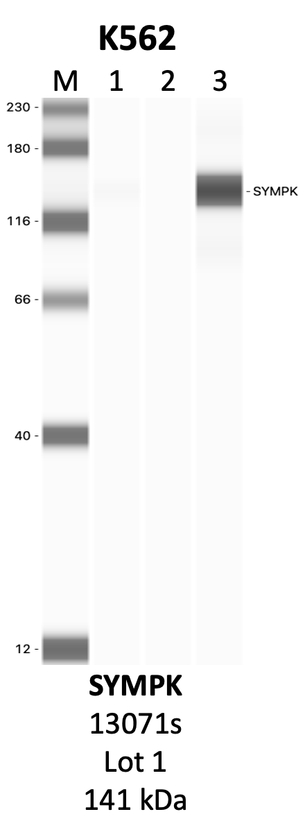 CST_13071S_1_SYMPK.png<br>Caption: IP-WB analysis of 13071S whole cell lysate using the SYMPK specific antibody, 13071S. Lanes 1 and 2 are 2.5% of five million whole cell lysate input and 50% of IP enrichment, respectively, using a normal IgG antibody. Lane 3 is 50% of IP enrichment from five million whole cell lysate using the SYMPK-specific antibody, 13071S. The same antibody was used to detect protein levels via Western blot. This antibody passes preliminary validation and will be further pursued for secondary validation. *NOTE* Protein sizes are taken from Genecards.org and are only estimates based on sequence. Actual protein size may differ based on protein characteristics and electrophoresis method used.