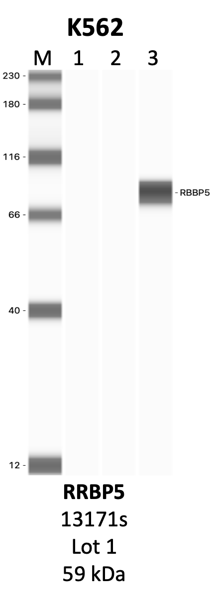 CST_13171S_1_RBBP5.png<br>Caption: IP-WB analysis of 13171S whole cell lysate using the RBBP5 specific antibody, 13171S. Lanes 1 and 2 are 2.5% of five million whole cell lysate input and 50% of IP enrichment, respectively, using a normal IgG antibody. Lane 3 is 50% of IP enrichment from five million whole cell lysate using the RBBP5-specific antibody, 13171S. The same antibody was used to detect protein levels via Western blot. This antibody passes preliminary validation and will be further pursued for secondary validation. *NOTE* Protein sizes are taken from Genecards.org and are only estimates based on sequence. Actual protein size may differ based on protein characteristics and electrophoresis method used.