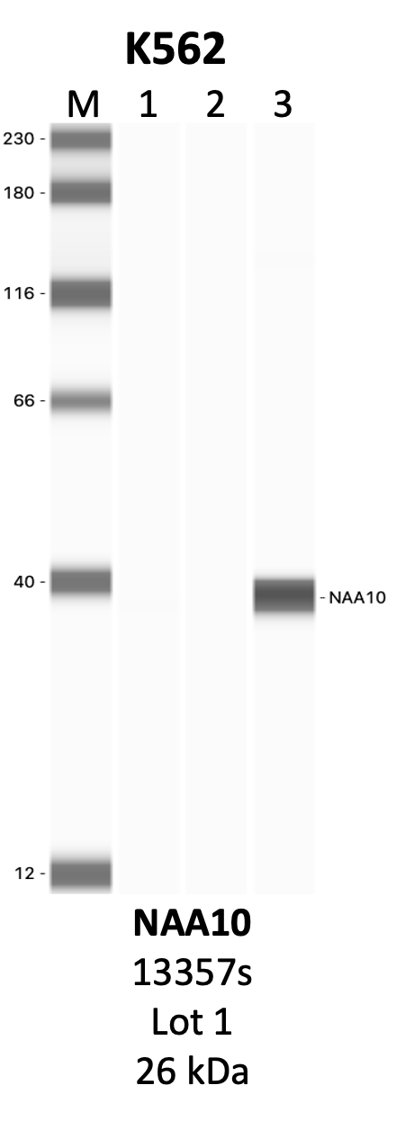 CST_13357S_1_NAA10.png<br>Caption: IP-WB analysis of 13357S whole cell lysate using the NAA10 specific antibody, 13357S. Lanes 1 and 2 are 2.5% of five million whole cell lysate input and 50% of IP enrichment, respectively, using a normal IgG antibody. Lane 3 is 50% of IP enrichment from five million whole cell lysate using the NAA10-specific antibody, 13357S. The same antibody was used to detect protein levels via Western blot. This antibody passes preliminary validation and will be further pursued for secondary validation. *NOTE* Protein sizes are taken from Genecards.org and are only estimates based on sequence. Actual protein size may differ based on protein characteristics and electrophoresis method used.