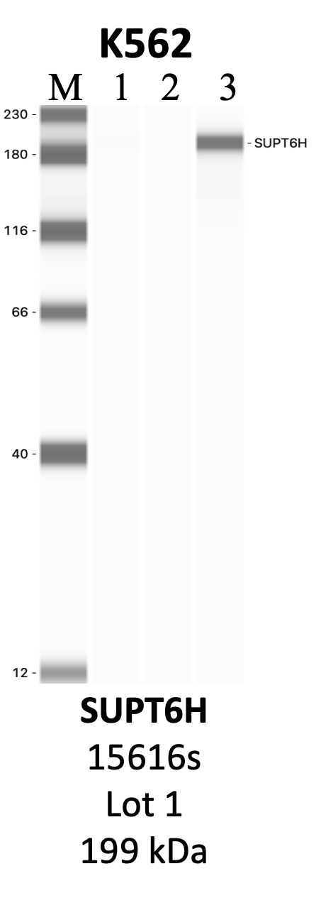 CST_15616S_1_SUPT6H.png<br>Caption: IP-WB analysis of 15616S whole cell lysate using the SUPT6H specific antibody, 15616S. Lanes 1 and 2 are 2.5% of five million whole cell lysate input and 50% of IP enrichment, respectively, using a normal IgG antibody. Lane 3 is 50% of IP enrichment from five million whole cell lysate using the SUPT6H-specific antibody, 15616S. The same antibody was used to detect protein levels via Western blot. This antibody passes preliminary validation and will be further pursued for secondary validation. *NOTE* Protein sizes are taken from Genecards.org and are only estimates based on sequence. Actual protein size may differ based on protein characteristics and electrophoresis method used.