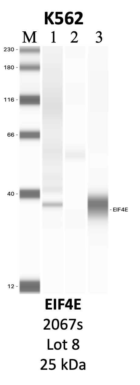 CST_2067S_8_EIF4E.png<br>Caption: IP-WB analysis of 2067S whole cell lysate using the EIF4E specific antibody, 2067S. Lanes 1 and 2 are 2.5% of five million whole cell lysate input and 50% of IP enrichment, respectively, using a normal IgG antibody. Lane 3 is 50% of IP enrichment from five million whole cell lysate using the EIF4E-specific antibody, 2067S. The same antibody was used to detect protein levels via Western blot. This antibody passes preliminary validation and will be further pursued for secondary validation. *NOTE* Protein sizes are taken from Genecards.org and are only estimates based on sequence. Actual protein size may differ based on protein characteristics and electrophoresis method used.