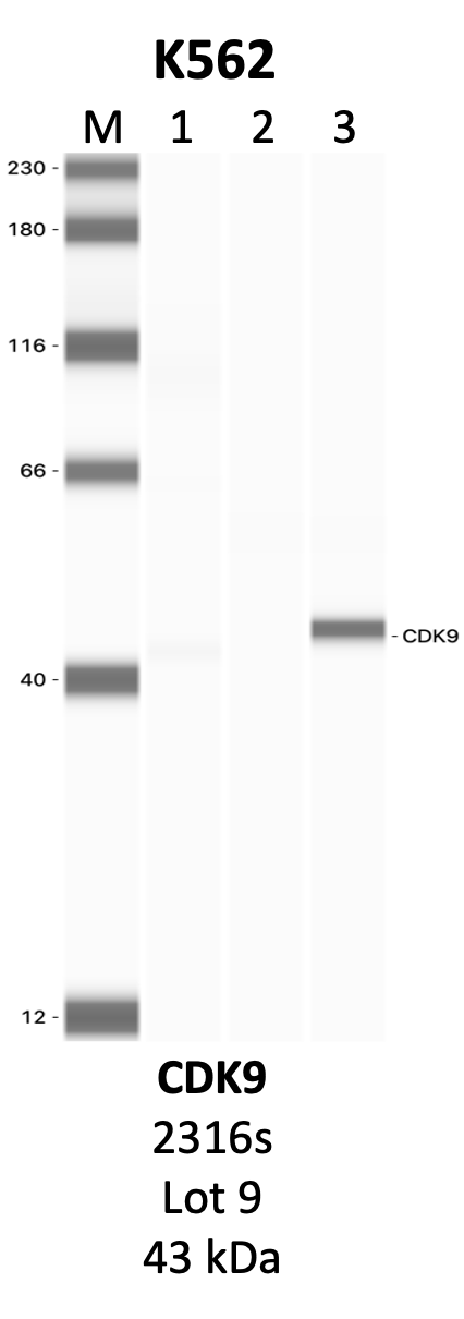 CST_2316S_9_CDK9.png<br>Caption: IP-WB analysis of 2316S whole cell lysate using the CDK9 specific antibody, 2316S. Lanes 1 and 2 are 2.5% of five million whole cell lysate input and 50% of IP enrichment, respectively, using a normal IgG antibody. Lane 3 is 50% of IP enrichment from five million whole cell lysate using the CDK9-specific antibody, 2316S. The same antibody was used to detect protein levels via Western blot. This antibody passes preliminary validation and will be further pursued for secondary validation. *NOTE* Protein sizes are taken from Genecards.org and are only estimates based on sequence. Actual protein size may differ based on protein characteristics and electrophoresis method used.