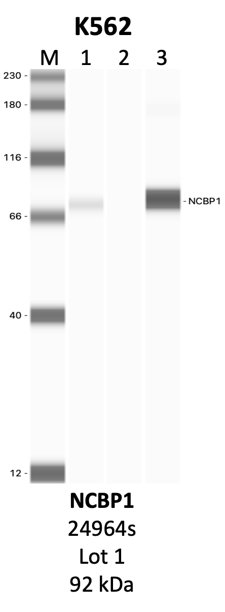 CST_24964S_1_NCBP1.png<br>Caption: IP-WB analysis of 24964S whole cell lysate using the NCBP1 specific antibody, 24964S. Lanes 1 and 2 are 2.5% of five million whole cell lysate input and 50% of IP enrichment, respectively, using a normal IgG antibody. Lane 3 is 50% of IP enrichment from five million whole cell lysate using the NCBP1-specific antibody, 24964S. The same antibody was used to detect protein levels via Western blot. This antibody passes preliminary validation and will be further pursued for secondary validation. *NOTE* Protein sizes are taken from Genecards.org and are only estimates based on sequence. Actual protein size may differ based on protein characteristics and electrophoresis method used.