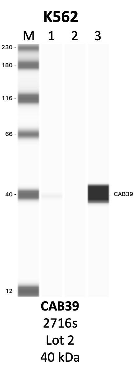 CST_2716S_2_CAB39.png<br>Caption: IP-WB analysis of 2716S whole cell lysate using the CAB39 specific antibody, 2716S. Lanes 1 and 2 are 2.5% of five million whole cell lysate input and 50% of IP enrichment, respectively, using a normal IgG antibody. Lane 3 is 50% of IP enrichment from five million whole cell lysate using the CAB39-specific antibody, 2716S. The same antibody was used to detect protein levels via Western blot. This antibody passes preliminary validation and will be further pursued for secondary validation. *NOTE* Protein sizes are taken from Genecards.org and are only estimates based on sequence. Actual protein size may differ based on protein characteristics and electrophoresis method used.