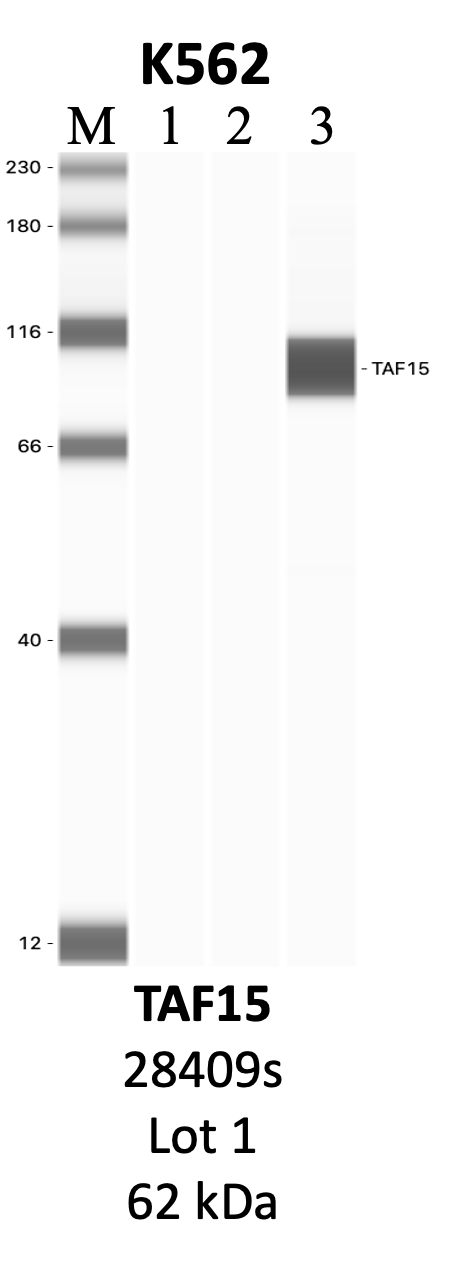 CST_28409S_1_TAF15.png<br>Caption: IP-WB analysis of 28409S whole cell lysate using the TAF15 specific antibody, 28409S. Lanes 1 and 2 are 2.5% of five million whole cell lysate input and 50% of IP enrichment, respectively, using a normal IgG antibody. Lane 3 is 50% of IP enrichment from five million whole cell lysate using the TAF15-specific antibody, 28409S. The same antibody was used to detect protein levels via Western blot. This antibody passes preliminary validation and will be further pursued for secondary validation. *NOTE* Protein sizes are taken from Genecards.org and are only estimates based on sequence. Actual protein size may differ based on protein characteristics and electrophoresis method used.