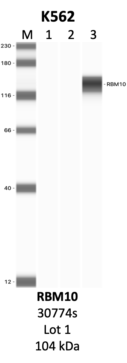 CST_30774S_1_RBM10.png<br>Caption: IP-WB analysis of 30774S whole cell lysate using the RBM10 specific antibody, 30774S. Lanes 1 and 2 are 2.5% of five million whole cell lysate input and 50% of IP enrichment, respectively, using a normal IgG antibody. Lane 3 is 50% of IP enrichment from five million whole cell lysate using the RBM10-specific antibody, 30774S. The same antibody was used to detect protein levels via Western blot. This antibody passes preliminary validation and will be further pursued for secondary validation. *NOTE* Protein sizes are taken from Genecards.org and are only estimates based on sequence. Actual protein size may differ based on protein characteristics and electrophoresis method used.