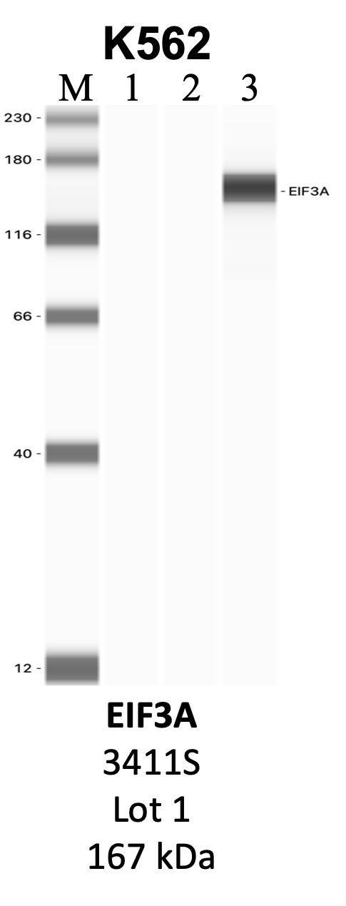 CST_3411S_1_EIF3A.png<br>Caption: IP-WB analysis of whole cell lysate using the EIF3A specific antibody, 3411S. Lanes 1 and 2 are 2.5% of five million whole cell lysate input and 50% of IP enrichment, respectively, using a normal IgG antibody. Lane 3 is 50% of IP enrichment from five million whole cell lysate using the EIF3A-specific antibody, 3411S. The same antibody was used to detect protein levels via Western blot. This antibody passes preliminary validation and will be further pursued for secondary validation. *NOTE* Protein sizes are taken from Genecards.org and are only estimates based on sequence. Actual protein size may differ based on protein characteristics and electrophoresis method used.