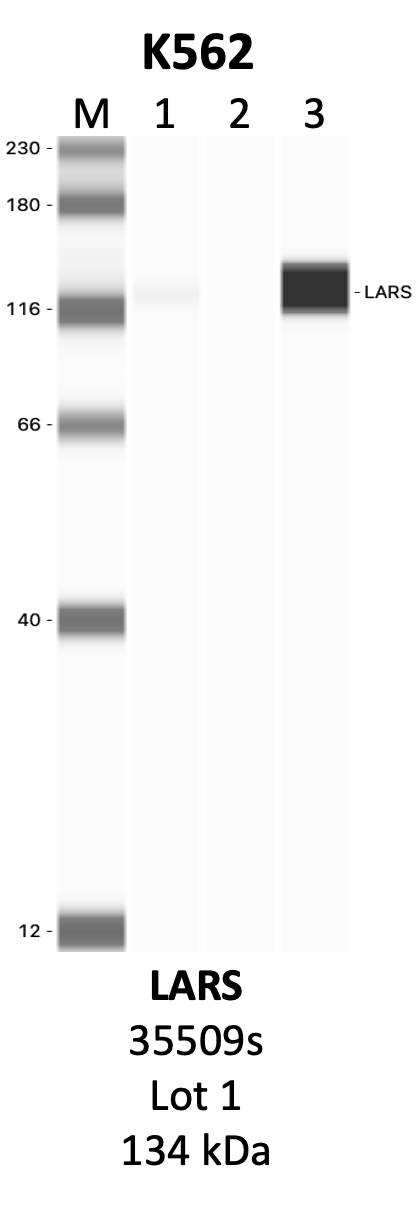 CST_35509S_1_LARS.png<br>Caption: IP-WB analysis of 35509S whole cell lysate using the LARS specific antibody, 35509S. Lanes 1 and 2 are 2.5% of five million whole cell lysate input and 50% of IP enrichment, respectively, using a normal IgG antibody. Lane 3 is 50% of IP enrichment from five million whole cell lysate using the LARS-specific antibody, 35509S. The same antibody was used to detect protein levels via Western blot. This antibody passes preliminary validation and will be further pursued for secondary validation. *NOTE* Protein sizes are taken from Genecards.org and are only estimates based on sequence. Actual protein size may differ based on protein characteristics and electrophoresis method used.