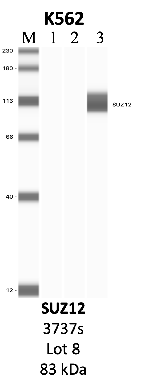 CST_3737S_8_SUZ12.png<br>Caption: IP-WB analysis of 3737S whole cell lysate using the SUZ12 specific antibody, 3737S. Lanes 1 and 2 are 2.5% of five million whole cell lysate input and 50% of IP enrichment, respectively, using a normal IgG antibody. Lane 3 is 50% of IP enrichment from five million whole cell lysate using the SUZ12-specific antibody, 3737S. The same antibody was used to detect protein levels via Western blot. This antibody passes preliminary validation and will be further pursued for secondary validation. *NOTE* Protein sizes are taken from Genecards.org and are only estimates based on sequence. Actual protein size may differ based on protein characteristics and electrophoresis method used.