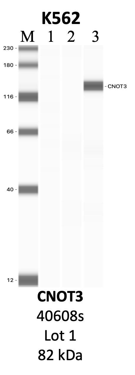 CST_40608S_1_CNOT3.png<br>Caption: IP-WB analysis of 40608S whole cell lysate using the CNOT3 specific antibody, 40608S. Lanes 1 and 2 are 2.5% of five million whole cell lysate input and 50% of IP enrichment, respectively, using a normal IgG antibody. Lane 3 is 50% of IP enrichment from five million whole cell lysate using the CNOT3-specific antibody, 40608S. The same antibody was used to detect protein levels via Western blot. This antibody passes preliminary validation and will be further pursued for secondary validation. *NOTE* Protein sizes are taken from Genecards.org and are only estimates based on sequence. Actual protein size may differ based on protein characteristics and electrophoresis method used.