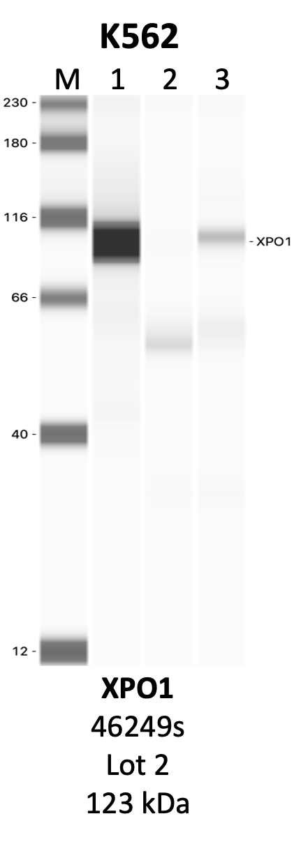 CST_46249S_2_XPO1.png<br>Caption: IP-WB analysis of 46249S whole cell lysate using the XPO1 specific antibody, 46249S. Lanes 1 and 2 are 2.5% of five million whole cell lysate input and 50% of IP enrichment, respectively, using a normal IgG antibody. Lane 3 is 50% of IP enrichment from five million whole cell lysate using the XPO1-specific antibody, 46249S. The same antibody was used to detect protein levels via Western blot. This antibody passes preliminary validation and will be further pursued for secondary validation. *NOTE* Protein sizes are taken from Genecards.org and are only estimates based on sequence. Actual protein size may differ based on protein characteristics and electrophoresis method used.