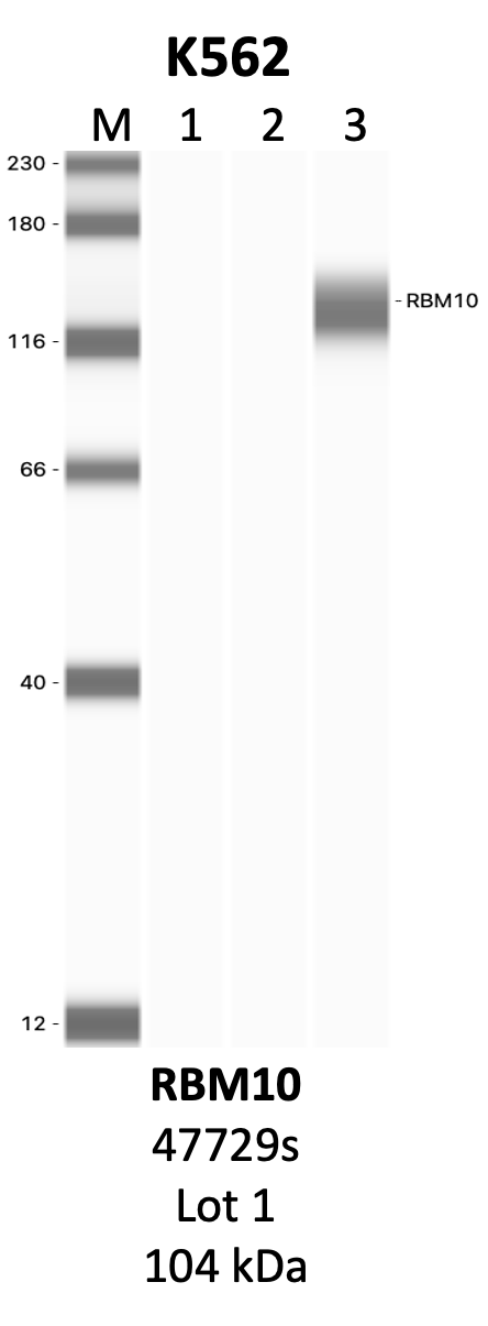 CST_47729S_1_RBM10.png<br>Caption: IP-WB analysis of 47729S whole cell lysate using the RBM10 specific antibody, 47729S. Lanes 1 and 2 are 2.5% of five million whole cell lysate input and 50% of IP enrichment, respectively, using a normal IgG antibody. Lane 3 is 50% of IP enrichment from five million whole cell lysate using the RBM10-specific antibody, 47729S. The same antibody was used to detect protein levels via Western blot. This antibody passes preliminary validation and will be further pursued for secondary validation. *NOTE* Protein sizes are taken from Genecards.org and are only estimates based on sequence. Actual protein size may differ based on protein characteristics and electrophoresis method used.