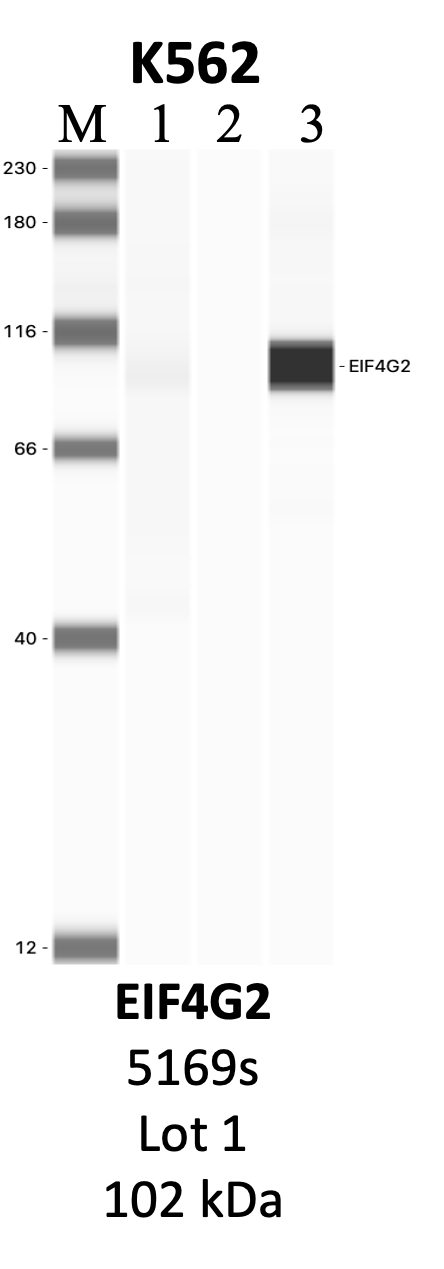 CST_5169S_1_EIF4G2.png<br>Caption: IP-WB analysis of 5169S whole cell lysate using the EIF4G2 specific antibody, 5169S. Lanes 1 and 2 are 2.5% of five million whole cell lysate input and 50% of IP enrichment, respectively, using a normal IgG antibody. Lane 3 is 50% of IP enrichment from five million whole cell lysate using the EIF4G2-specific antibody, 5169S. The same antibody was used to detect protein levels via Western blot. This antibody passes preliminary validation and will be further pursued for secondary validation. *NOTE* Protein sizes are taken from Genecards.org and are only estimates based on sequence. Actual protein size may differ based on protein characteristics and electrophoresis method used.