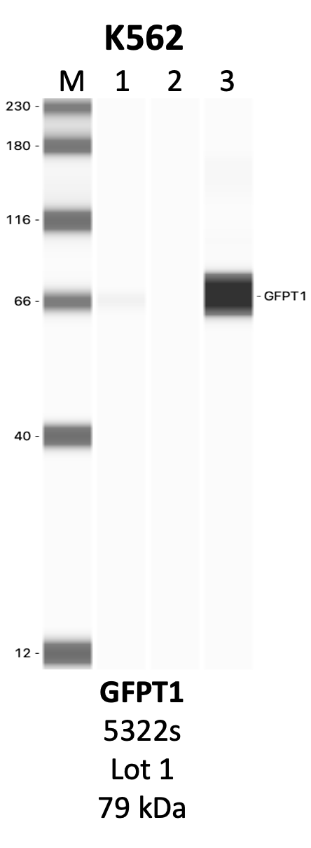 CST_5322S_1_GFPT1.png<br>Caption: IP-WB analysis of 5322S whole cell lysate using the GFPT1 specific antibody, 5322S. Lanes 1 and 2 are 2.5% of five million whole cell lysate input and 50% of IP enrichment, respectively, using a normal IgG antibody. Lane 3 is 50% of IP enrichment from five million whole cell lysate using the GFPT1-specific antibody, 5322S. The same antibody was used to detect protein levels via Western blot. This antibody passes preliminary validation and will be further pursued for secondary validation. *NOTE* Protein sizes are taken from Genecards.org and are only estimates based on sequence. Actual protein size may differ based on protein characteristics and electrophoresis method used.