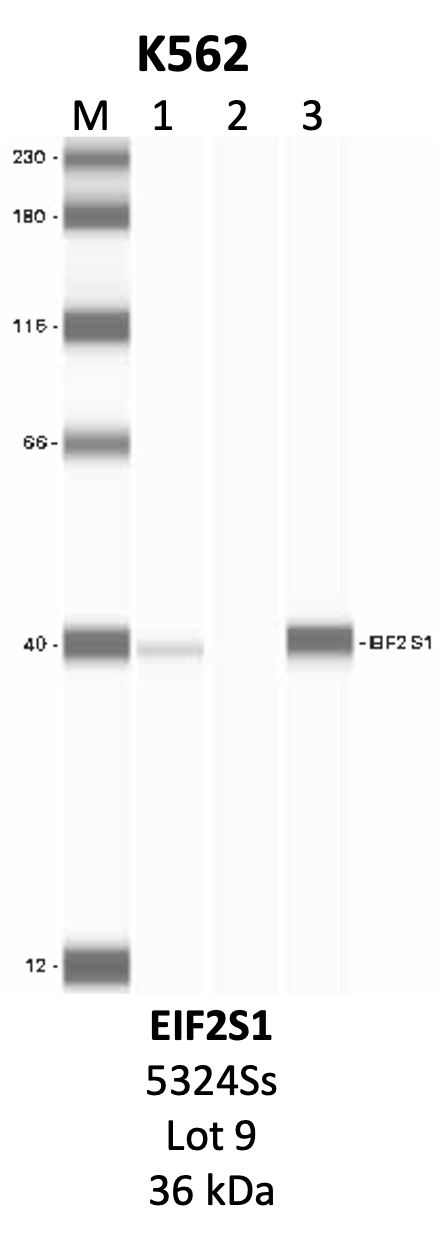 CST_5324S_9_EIF2S1.png<br>Caption: IP-WB analysis of 5324S whole cell lysate using the EIF2S1 specific antibody, 5324S. Lanes 1 and 2 are 2.5% of five million whole cell lysate input and 50% of IP enrichment, respectively, using a normal IgG antibody. Lane 3 is 50% of IP enrichment from five million whole cell lysate using the EIF2S1-specific antibody, 5324S. The same antibody was used to detect protein levels via Western blot. This antibody passes preliminary validation and will be further pursued for secondary validation. *NOTE* Protein sizes are taken from Genecards.org and are only estimates based on sequence. Actual protein size may differ based on protein characteristics and electrophoresis method used.