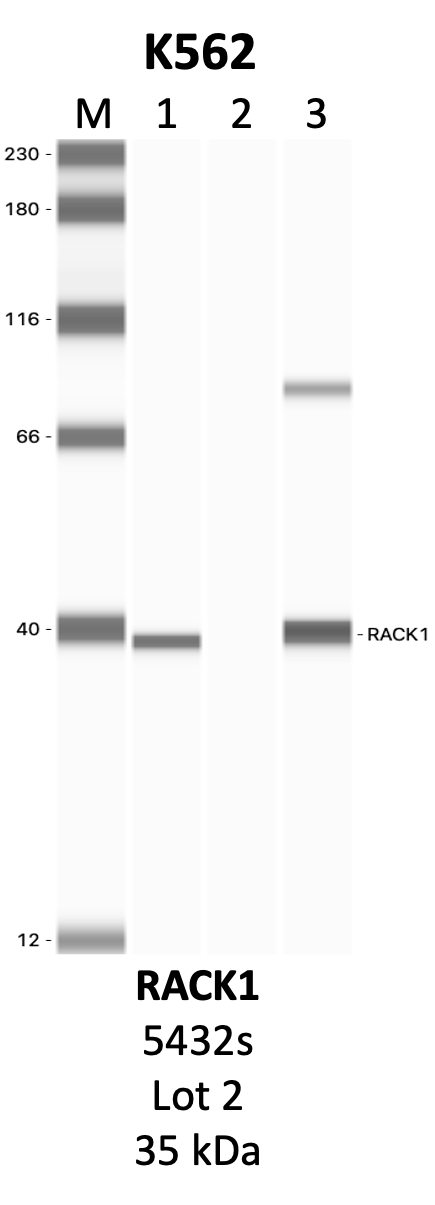 CST_5432S_2_RACK1.png<br>Caption: IP-WB analysis of 5432S whole cell lysate using the RACK1 specific antibody, 5432S. Lanes 1 and 2 are 2.5% of five million whole cell lysate input and 50% of IP enrichment, respectively, using a normal IgG antibody. Lane 3 is 50% of IP enrichment from five million whole cell lysate using the RACK1-specific antibody, 5432S. The same antibody was used to detect protein levels via Western blot. This antibody passes preliminary validation and will be further pursued for secondary validation. *NOTE* Protein sizes are taken from Genecards.org and are only estimates based on sequence. Actual protein size may differ based on protein characteristics and electrophoresis method used.