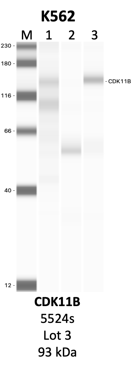 CST_5524S_3_CDK11B.png<br>Caption: IP-WB analysis of 5524S whole cell lysate using the CDK11B specific antibody, 5524S. Lanes 1 and 2 are 2.5% of five million whole cell lysate input and 50% of IP enrichment, respectively, using a normal IgG antibody. Lane 3 is 50% of IP enrichment from five million whole cell lysate using the CDK11B-specific antibody, 5524S. The same antibody was used to detect protein levels via Western blot. This antibody passes preliminary validation and will be further pursued for secondary validation. *NOTE* Protein sizes are taken from Genecards.org and are only estimates based on sequence. Actual protein size may differ based on protein characteristics and electrophoresis method used.