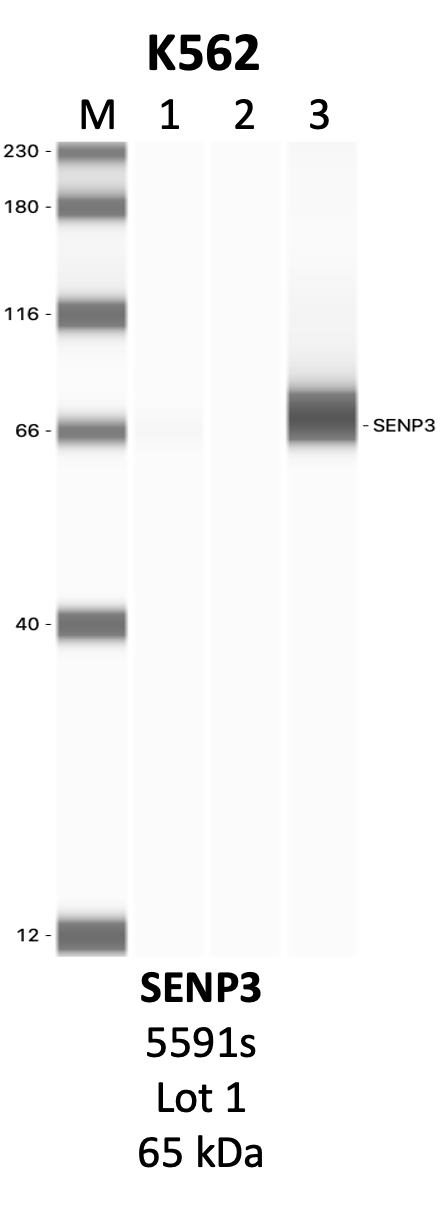 CST_5591S_1_SENP3.png<br>Caption: IP-WB analysis of 5591S whole cell lysate using the SENP3 specific antibody, 5591S. Lanes 1 and 2 are 2.5% of five million whole cell lysate input and 50% of IP enrichment, respectively, using a normal IgG antibody. Lane 3 is 50% of IP enrichment from five million whole cell lysate using the SENP3-specific antibody, 5591S. The same antibody was used to detect protein levels via Western blot. This antibody passes preliminary validation and will be further pursued for secondary validation. *NOTE* Protein sizes are taken from Genecards.org and are only estimates based on sequence. Actual protein size may differ based on protein characteristics and electrophoresis method used.