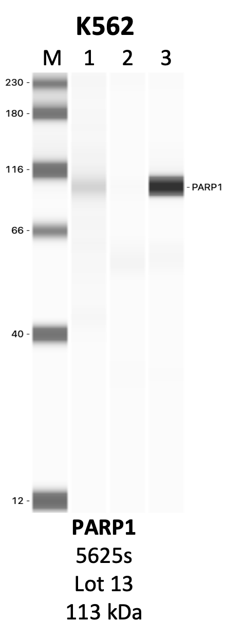 CST_5625S_13_PARP1.png<br>Caption: IP-WB analysis of 5625S whole cell lysate using the PARP1 specific antibody, 5625S. Lanes 1 and 2 are 2.5% of five million whole cell lysate input and 50% of IP enrichment, respectively, using a normal IgG antibody. Lane 3 is 50% of IP enrichment from five million whole cell lysate using the PARP1-specific antibody, 5625S. The same antibody was used to detect protein levels via Western blot. This antibody passes preliminary validation and will be further pursued for secondary validation. *NOTE* Protein sizes are taken from Genecards.org and are only estimates based on sequence. Actual protein size may differ based on protein characteristics and electrophoresis method used.