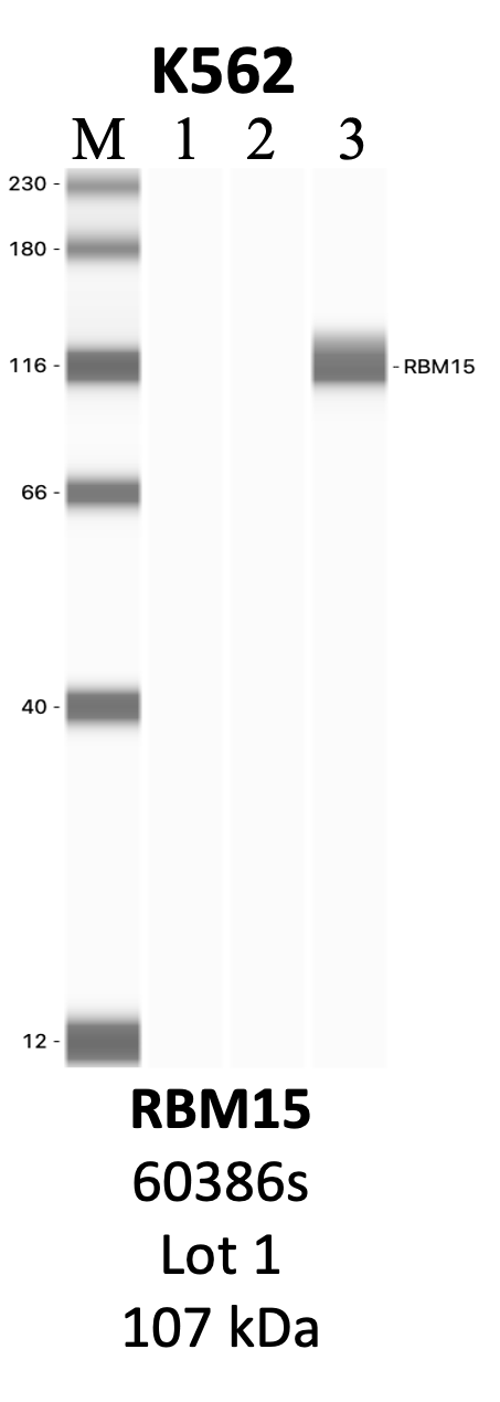 CST_60386S_1_RBM15.png<br>Caption: IP-WB analysis of 60386S whole cell lysate using the RBM15 specific antibody, 60386S. Lanes 1 and 2 are 2.5% of five million whole cell lysate input and 50% of IP enrichment, respectively, using a normal IgG antibody. Lane 3 is 50% of IP enrichment from five million whole cell lysate using the RBM15-specific antibody, 60386S. The same antibody was used to detect protein levels via Western blot. This antibody passes preliminary validation and will be further pursued for secondary validation. *NOTE* Protein sizes are taken from Genecards.org and are only estimates based on sequence. Actual protein size may differ based on protein characteristics and electrophoresis method used.