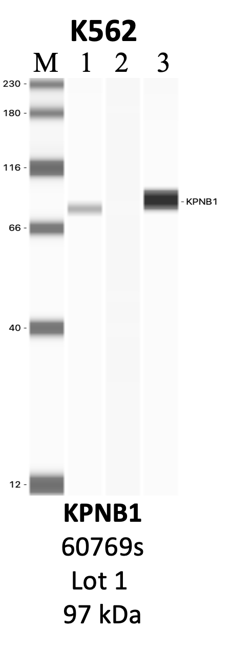 CST_60769S_1_KPNB1.png<br>Caption: IP-WB analysis of 60769S whole cell lysate using the KPNB1 specific antibody, 60769S. Lanes 1 and 2 are 2.5% of five million whole cell lysate input and 50% of IP enrichment, respectively, using a normal IgG antibody. Lane 3 is 50% of IP enrichment from five million whole cell lysate using the KPNB1-specific antibody, 60769S. The same antibody was used to detect protein levels via Western blot. This antibody passes preliminary validation and will be further pursued for secondary validation. *NOTE* Protein sizes are taken from Genecards.org and are only estimates based on sequence. Actual protein size may differ based on protein characteristics and electrophoresis method used.