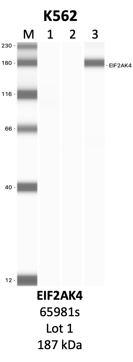 CST_65981S_1_EIF2AK4.png<br>Caption: IP-WB analysis of 65981S whole cell lysate using the EIF2AK4 specific antibody, 65981S. Lanes 1 and 2 are 2.5% of five million whole cell lysate input and 50% of IP enrichment, respectively, using a normal IgG antibody. Lane 3 is 50% of IP enrichment from five million whole cell lysate using the EIF2AK4-specific antibody, 65981S. The same antibody was used to detect protein levels via Western blot. This antibody passes preliminary validation and will be further pursued for secondary validation. *NOTE* Protein sizes are taken from Genecards.org and are only estimates based on sequence. Actual protein size may differ based on protein characteristics and electrophoresis method used.