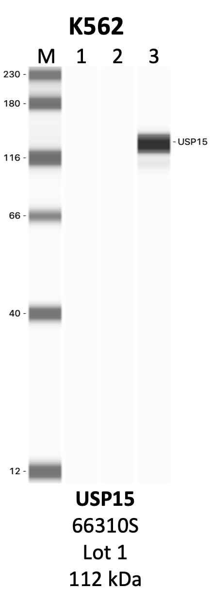 CST_66310S_1_USP15.png<br>Caption: IP-WB analysis of 66310S whole cell lysate using the USP15 specific antibody, 66310S. Lanes 1 and 2 are 2.5% of five million whole cell lysate input and 50% of IP enrichment, respectively, using a normal IgG antibody. Lane 3 is 50% of IP enrichment from five million whole cell lysate using the USP15-specific antibody, 66310S. The same antibody was used to detect protein levels via Western blot. This antibody passes preliminary validation and will be further pursued for secondary validation. *NOTE* Protein sizes are taken from Genecards.org and are only estimates based on sequence. Actual protein size may differ based on protein characteristics and electrophoresis method used.