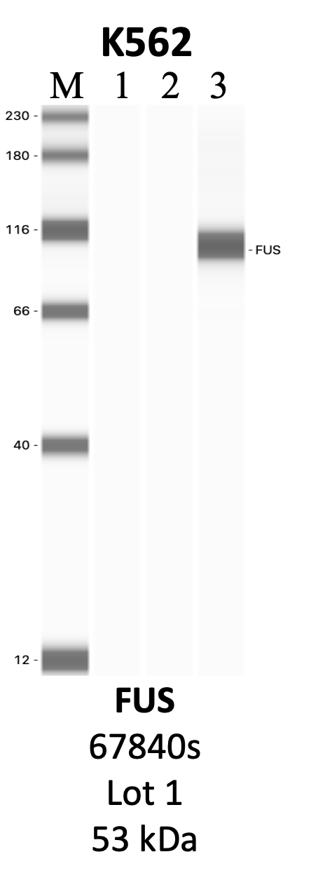 CST_67840S_1_FUS.png<br>Caption: IP-WB analysis of 67840S whole cell lysate using the FUS specific antibody, 67840S. Lanes 1 and 2 are 2.5% of five million whole cell lysate input and 50% of IP enrichment, respectively, using a normal IgG antibody. Lane 3 is 50% of IP enrichment from five million whole cell lysate using the FUS-specific antibody, 67840S. The same antibody was used to detect protein levels via Western blot. This antibody passes preliminary validation and will be further pursued for secondary validation. *NOTE* Protein sizes are taken from Genecards.org and are only estimates based on sequence. Actual protein size may differ based on protein characteristics and electrophoresis method used.