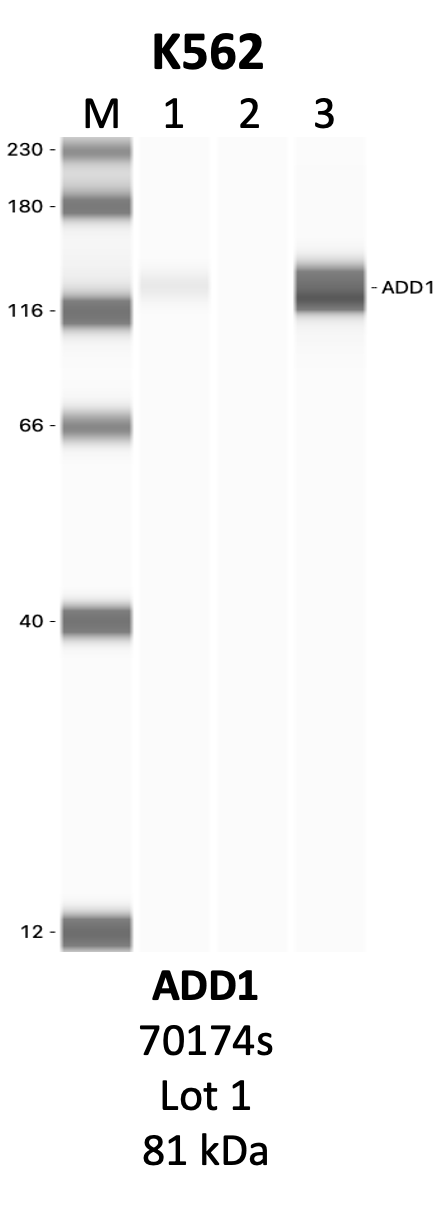 CST_70174S_1_ADD1.png<br>Caption: IP-WB analysis of 70174S whole cell lysate using the ADD1 specific antibody, 70174S. Lanes 1 and 2 are 2.5% of five million whole cell lysate input and 50% of IP enrichment, respectively, using a normal IgG antibody. Lane 3 is 50% of IP enrichment from five million whole cell lysate using the ADD1-specific antibody, 70174S. The same antibody was used to detect protein levels via Western blot. This antibody passes preliminary validation and will be further pursued for secondary validation. *NOTE* Protein sizes are taken from Genecards.org and are only estimates based on sequence. Actual protein size may differ based on protein characteristics and electrophoresis method used.