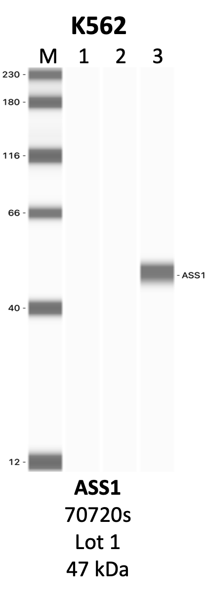 CST_70720S_1_ASS1.png<br>Caption: IP-WB analysis of 70720S whole cell lysate using the ASS1 specific antibody, 70720S. Lanes 1 and 2 are 2.5% of five million whole cell lysate input and 50% of IP enrichment, respectively, using a normal IgG antibody. Lane 3 is 50% of IP enrichment from five million whole cell lysate using the ASS1-specific antibody, 70720S. The same antibody was used to detect protein levels via Western blot. This antibody passes preliminary validation and will be further pursued for secondary validation. *NOTE* Protein sizes are taken from Genecards.org and are only estimates based on sequence. Actual protein size may differ based on protein characteristics and electrophoresis method used.