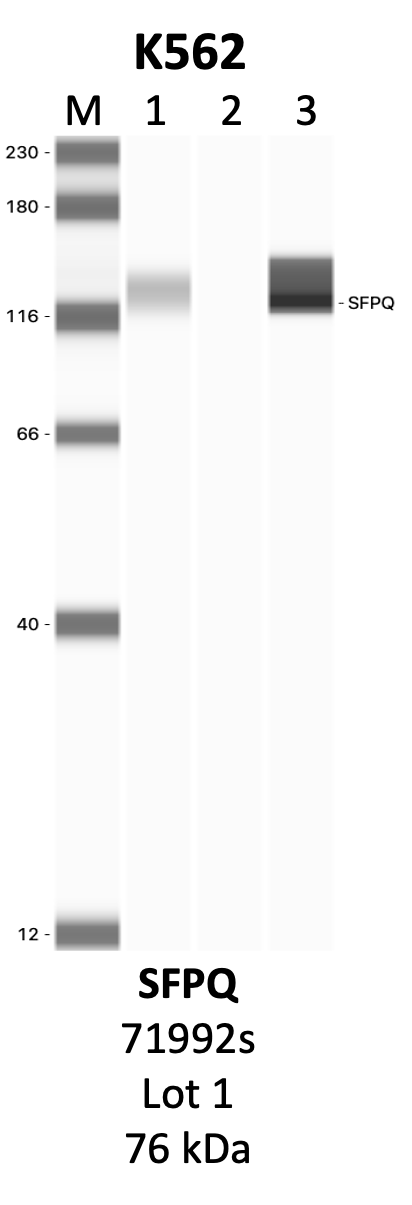 CST_71992S_1_SFPQ.png<br>Caption: IP-WB analysis of 71992S whole cell lysate using the SFPQ specific antibody, 71992S. Lanes 1 and 2 are 2.5% of five million whole cell lysate input and 50% of IP enrichment, respectively, using a normal IgG antibody. Lane 3 is 50% of IP enrichment from five million whole cell lysate using the SFPQ-specific antibody, 71992S. The same antibody was used to detect protein levels via Western blot. This antibody passes preliminary validation and will be further pursued for secondary validation. *NOTE* Protein sizes are taken from Genecards.org and are only estimates based on sequence. Actual protein size may differ based on protein characteristics and electrophoresis method used.