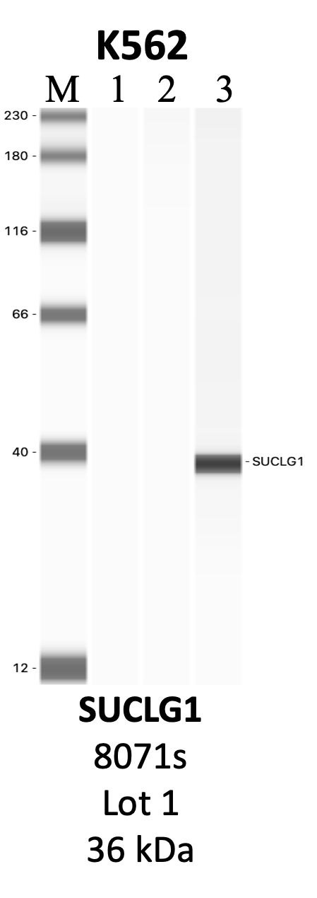 CST_8071S_1_SUCLG1.png<br>Caption: IP-WB analysis of 8071S whole cell lysate using the SUCLG1 specific antibody, 8071S. Lanes 1 and 2 are 2.5% of five million whole cell lysate input and 50% of IP enrichment, respectively, using a normal IgG antibody. Lane 3 is 50% of IP enrichment from five million whole cell lysate using the SUCLG1-specific antibody, 8071S. The same antibody was used to detect protein levels via Western blot. This antibody passes preliminary validation and will be further pursued for secondary validation. *NOTE* Protein sizes are taken from Genecards.org and are only estimates based on sequence. Actual protein size may differ based on protein characteristics and electrophoresis method used.