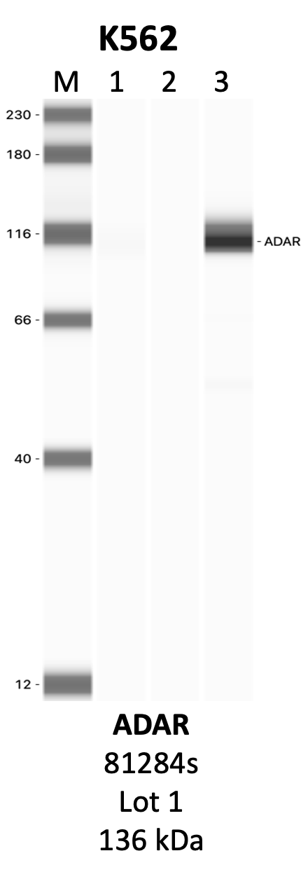 CST_81284S_1_ADAR.png<br>Caption: IP-WB analysis of 81284S whole cell lysate using the ADAR specific antibody, 81284S. Lanes 1 and 2 are 2.5% of five million whole cell lysate input and 50% of IP enrichment, respectively, using a normal IgG antibody. Lane 3 is 50% of IP enrichment from five million whole cell lysate using the ADAR-specific antibody, 81284S. The same antibody was used to detect protein levels via Western blot. This antibody passes preliminary validation and will be further pursued for secondary validation. *NOTE* Protein sizes are taken from Genecards.org and are only estimates based on sequence. Actual protein size may differ based on protein characteristics and electrophoresis method used.