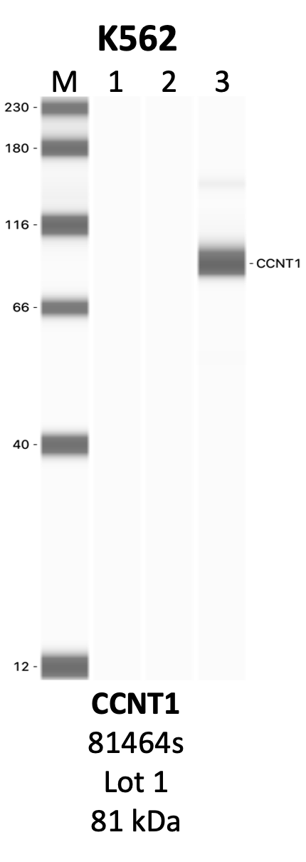 CST_81464S_1_CCNT1.png<br>Caption: IP-WB analysis of 81464S whole cell lysate using the CCNT1 specific antibody, 81464S. Lanes 1 and 2 are 2.5% of five million whole cell lysate input and 50% of IP enrichment, respectively, using a normal IgG antibody. Lane 3 is 50% of IP enrichment from five million whole cell lysate using the CCNT1-specific antibody, 81464S. The same antibody was used to detect protein levels via Western blot. This antibody passes preliminary validation and will be further pursued for secondary validation. *NOTE* Protein sizes are taken from Genecards.org and are only estimates based on sequence. Actual protein size may differ based on protein characteristics and electrophoresis method used.