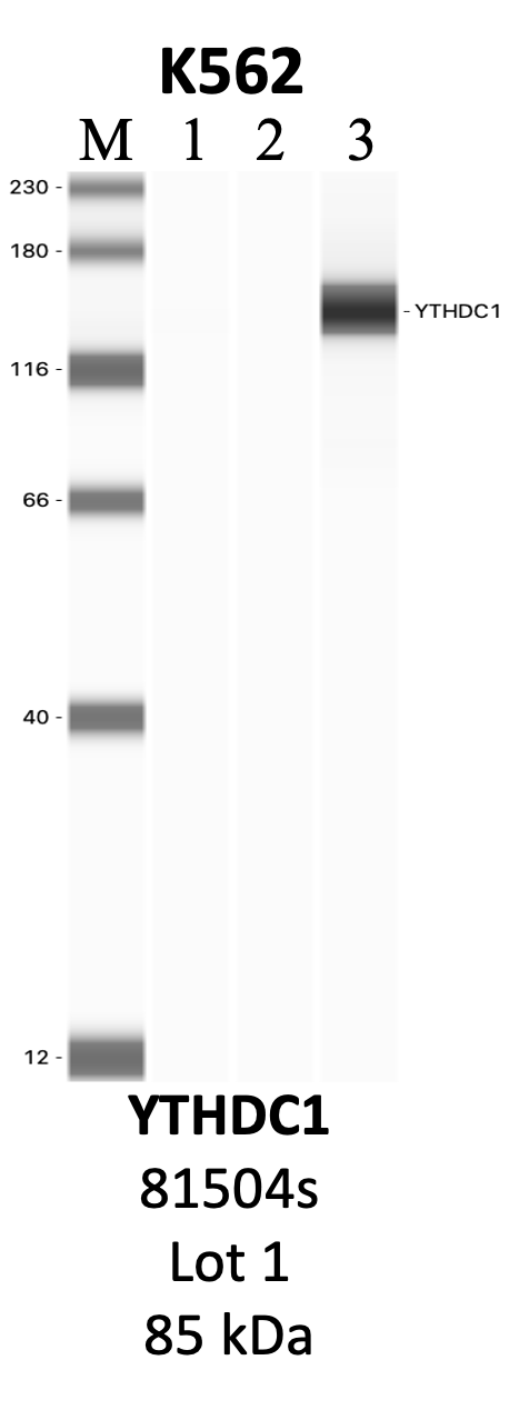 CST_81504S_1_YTHDC1.png<br>Caption: IP-WB analysis of 81504S whole cell lysate using the YTHDC1 specific antibody, 81504S. Lanes 1 and 2 are 2.5% of five million whole cell lysate input and 50% of IP enrichment, respectively, using a normal IgG antibody. Lane 3 is 50% of IP enrichment from five million whole cell lysate using the YTHDC1-specific antibody, 81504S. The same antibody was used to detect protein levels via Western blot. This antibody passes preliminary validation and will be further pursued for secondary validation. *NOTE* Protein sizes are taken from Genecards.org and are only estimates based on sequence. Actual protein size may differ based on protein characteristics and electrophoresis method used.