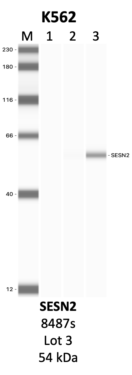 CST_8487S_3_SESN2.png<br>Caption: IP-WB analysis of 8487S whole cell lysate using the SESN2 specific antibody, 8487S. Lanes 1 and 2 are 2.5% of five million whole cell lysate input and 50% of IP enrichment, respectively, using a normal IgG antibody. Lane 3 is 50% of IP enrichment from five million whole cell lysate using the SESN2-specific antibody, 8487S. The same antibody was used to detect protein levels via Western blot. This antibody passes preliminary validation and will be further pursued for secondary validation. *NOTE* Protein sizes are taken from Genecards.org and are only estimates based on sequence. Actual protein size may differ based on protein characteristics and electrophoresis method used.