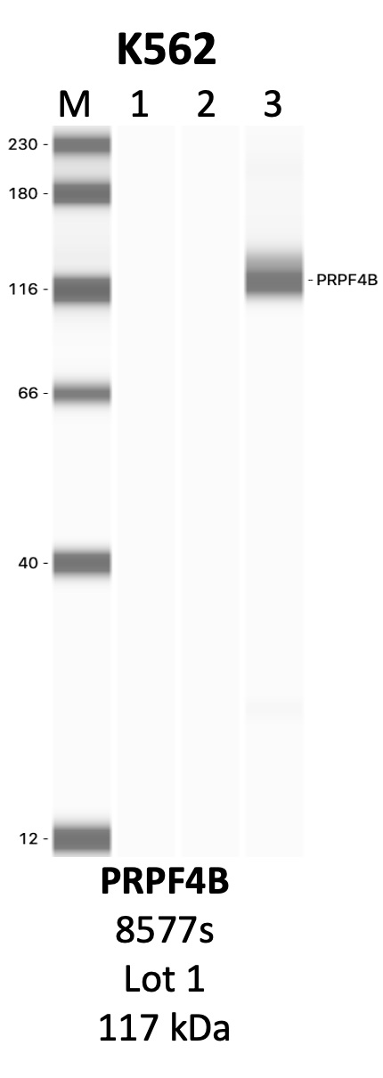 CST_8577S_1_PRPF4B.png<br>Caption: IP-WB analysis of 8577S whole cell lysate using the PRPF4B specific antibody, 8577S. Lanes 1 and 2 are 2.5% of five million whole cell lysate input and 50% of IP enrichment, respectively, using a normal IgG antibody. Lane 3 is 50% of IP enrichment from five million whole cell lysate using the PRPF4B-specific antibody, 8577S. The same antibody was used to detect protein levels via Western blot. This antibody passes preliminary validation and will be further pursued for secondary validation. *NOTE* Protein sizes are taken from Genecards.org and are only estimates based on sequence. Actual protein size may differ based on protein characteristics and electrophoresis method used.