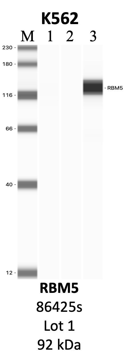 CST_86425S_1_RBM5.png<br>Caption: IP-WB analysis of 86425S whole cell lysate using the RBM5 specific antibody, 86425S. Lanes 1 and 2 are 2.5% of five million whole cell lysate input and 50% of IP enrichment, respectively, using a normal IgG antibody. Lane 3 is 50% of IP enrichment from five million whole cell lysate using the RBM5-specific antibody, 86425S. The same antibody was used to detect protein levels via Western blot. This antibody passes preliminary validation and will be further pursued for secondary validation. *NOTE* Protein sizes are taken from Genecards.org and are only estimates based on sequence. Actual protein size may differ based on protein characteristics and electrophoresis method used.