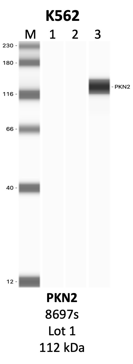 CST_8697S_1_PKN2.png<br>Caption: IP-WB analysis of 8697S whole cell lysate using the PKN2 specific antibody, 8697S. Lanes 1 and 2 are 2.5% of five million whole cell lysate input and 50% of IP enrichment, respectively, using a normal IgG antibody. Lane 3 is 50% of IP enrichment from five million whole cell lysate using the PKN2-specific antibody, 8697S. The same antibody was used to detect protein levels via Western blot. This antibody passes preliminary validation and will be further pursued for secondary validation. *NOTE* Protein sizes are taken from Genecards.org and are only estimates based on sequence. Actual protein size may differ based on protein characteristics and electrophoresis method used.