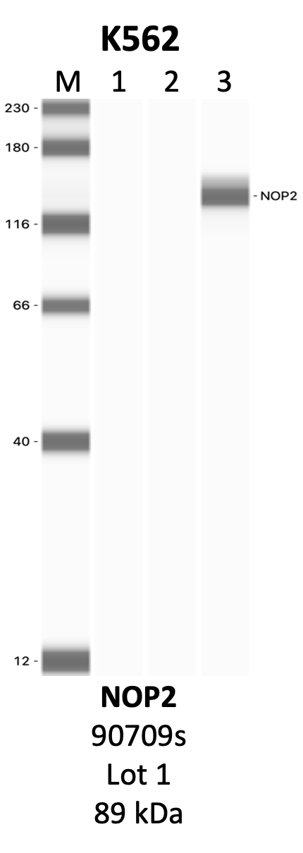 CST_90709S_1_NOP2.png<br>Caption: IP-WB analysis of 90709S whole cell lysate using the NOP2 specific antibody, 90709S. Lanes 1 and 2 are 2.5% of five million whole cell lysate input and 50% of IP enrichment, respectively, using a normal IgG antibody. Lane 3 is 50% of IP enrichment from five million whole cell lysate using the NOP2-specific antibody, 90709S. The same antibody was used to detect protein levels via Western blot. This antibody passes preliminary validation and will be further pursued for secondary validation. *NOTE* Protein sizes are taken from Genecards.org and are only estimates based on sequence. Actual protein size may differ based on protein characteristics and electrophoresis method used.