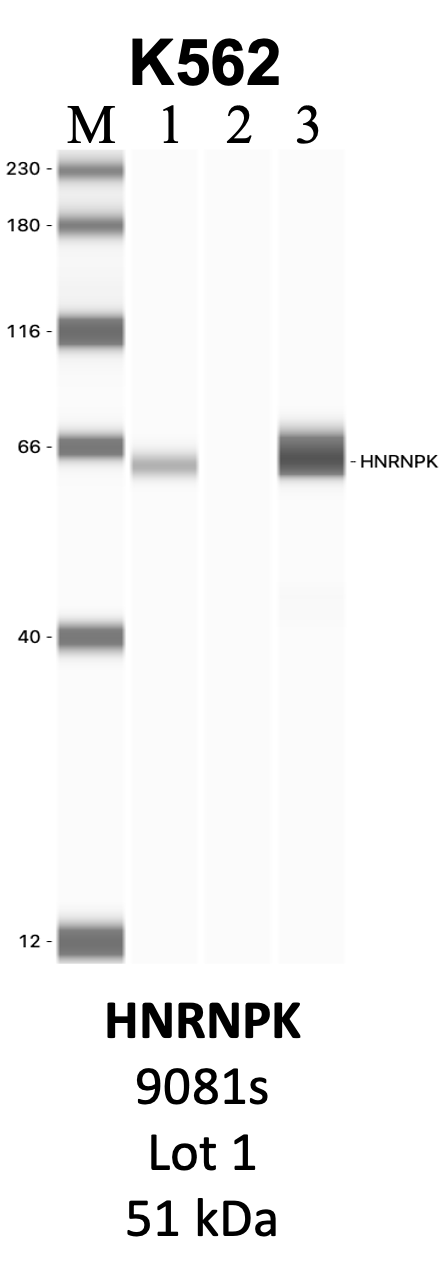 CST_9081S_1_HNRNPK.png<br>Caption: IP-WB analysis of 9081S whole cell lysate using the HNRNPK specific antibody, 9081S. Lanes 1 and 2 are 2.5% of five million whole cell lysate input and 50% of IP enrichment, respectively, using a normal IgG antibody. Lane 3 is 50% of IP enrichment from five million whole cell lysate using the HNRNPK-specific antibody, 9081S. The same antibody was used to detect protein levels via Western blot. This antibody passes preliminary validation and will be further pursued for secondary validation. *NOTE* Protein sizes are taken from Genecards.org and are only estimates based on sequence. Actual protein size may differ based on protein characteristics and electrophoresis method used.